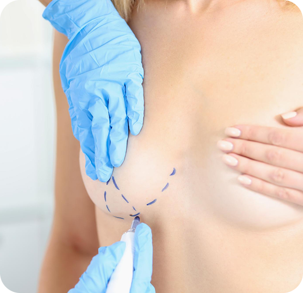 Przygotowanie do zabiegu medycyny estetycznej przybliżenie na kobiece piersi.