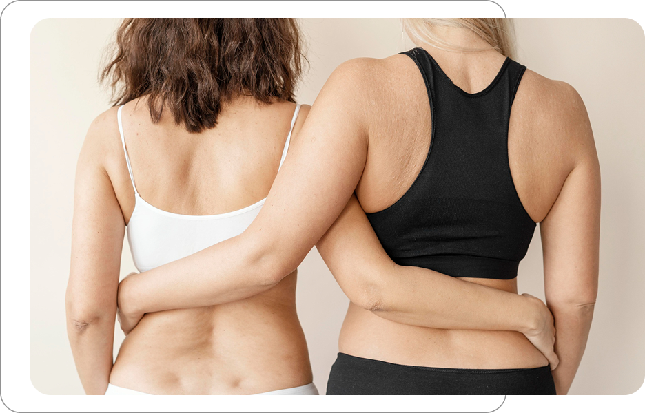 Dwie kobiety obejmujące się, prezentujące naturalne sylwetki i zdrową skórę, widok od tyłu.