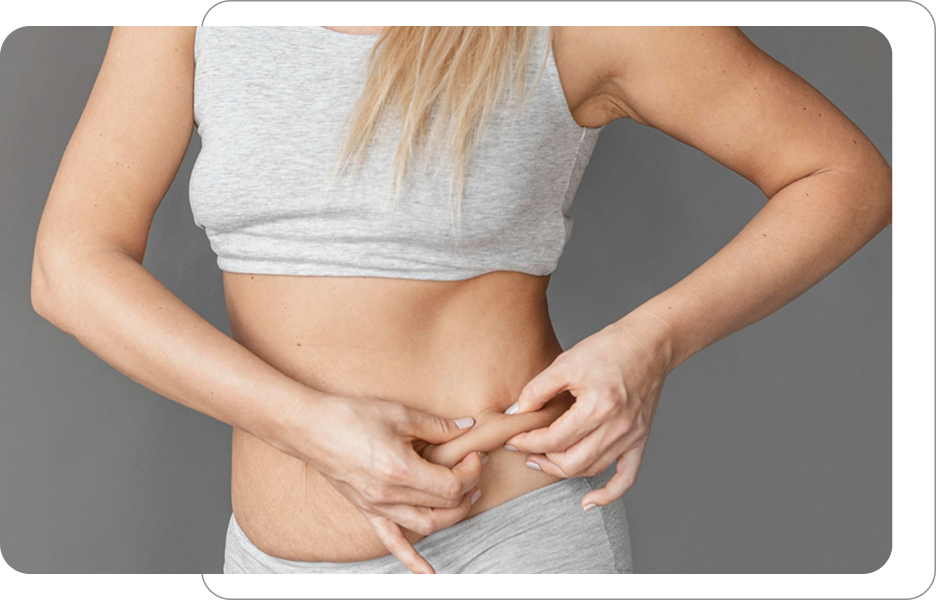 Kobieta trzymająca fałd skóry i tkanki tłuszczowej na brzuchu, ilustracja do zabiegów modelowania sylwetki i ujędrniania skóry.